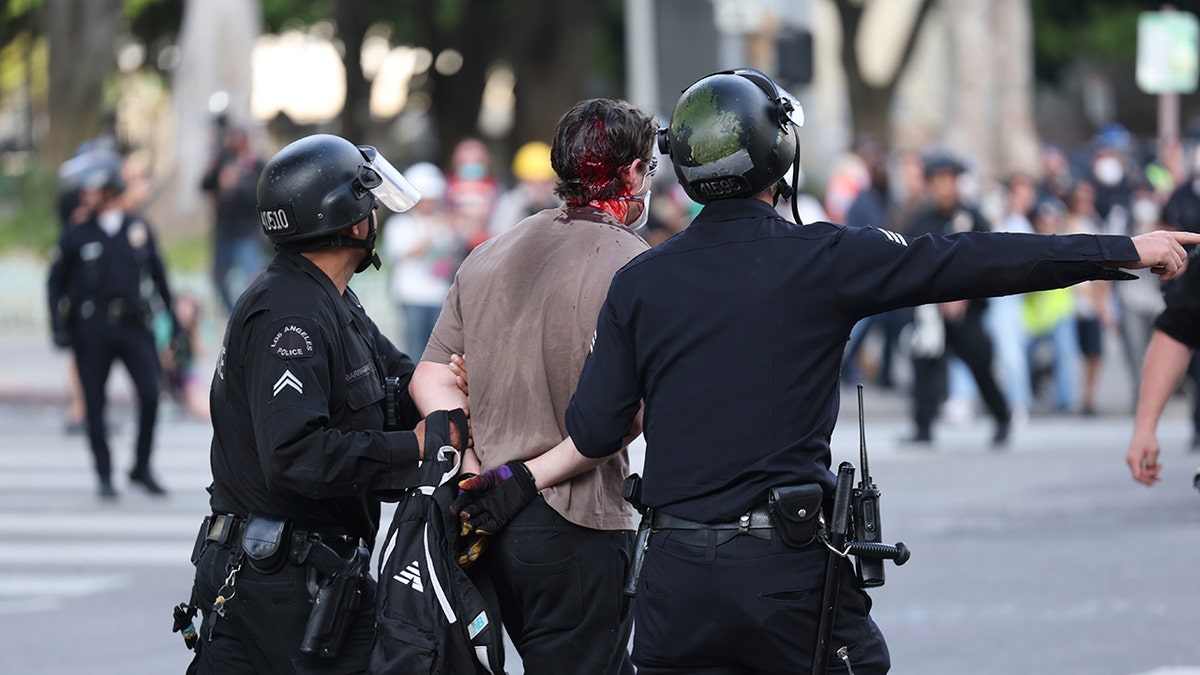 Bloody man arrested in Los Angeles